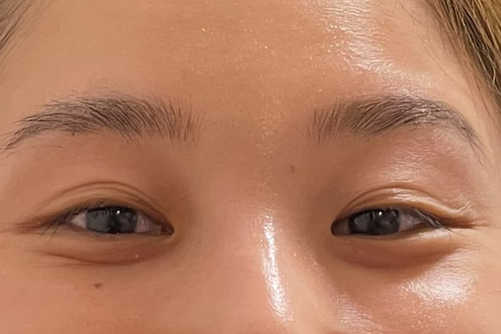 1回目の施術から2か月後の眉毛